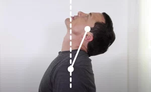 Measure Neck Extension by tilting your head back looking up at the sky